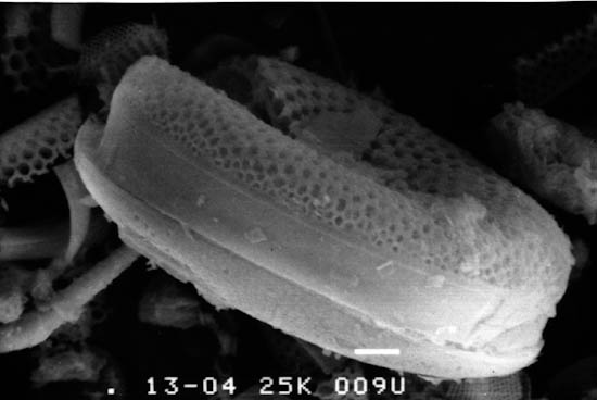 珪藻土電子顕微鏡写真1.JPG