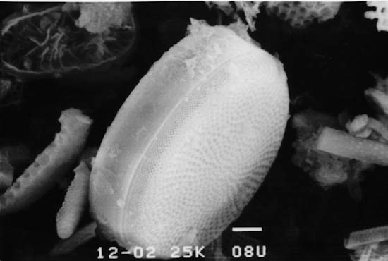 珪藻土電子顕微鏡写真2.JPG